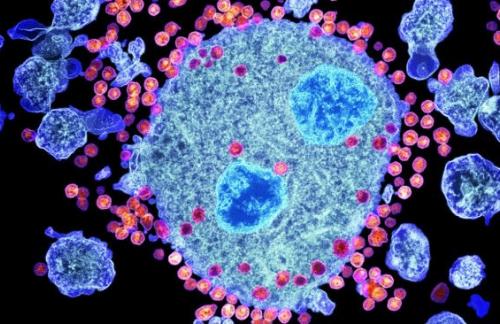 Экспериментальная иммунотерапия ВИЧ прошла первый этап испытаний безопасности