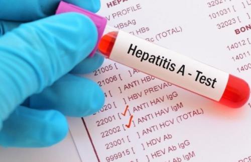 Гепатит в Чернигове: заболели уже трое взрослых и 23 ребенка
