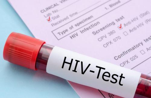 Новая вакцина от ВИЧ показала хорошие результаты в испытаниях на людях